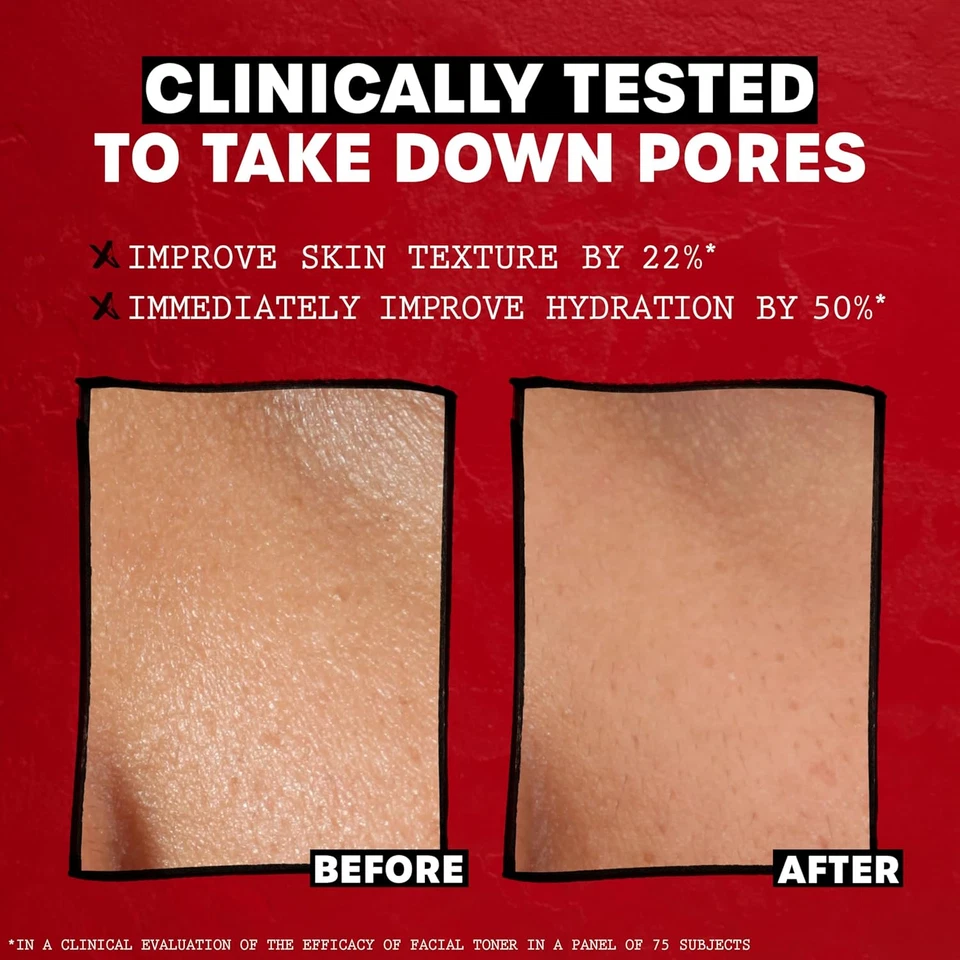 Thayers Witch Hazel Facial Gentle Rose Petal Toner Lotion with Organic Aloe Vera - Image 4 of 4