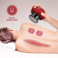 Smart Electric Cupping Massage Suction Vacuum Scraping Therapy Machine Slimming