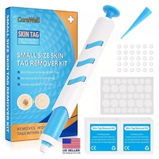 Skin Tag Removal Tool Kit Rubber Bands Home Use Wart Acne Micro Skintag Remover