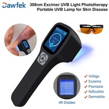 308nm UVB Phototherapy Device with LED Display for Home Skin Care Plug and Play