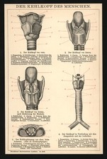 Druck anno 1896 - Kehlkopf Adamsapfel Medizin Larynx Anatomie Laryngologie HNO