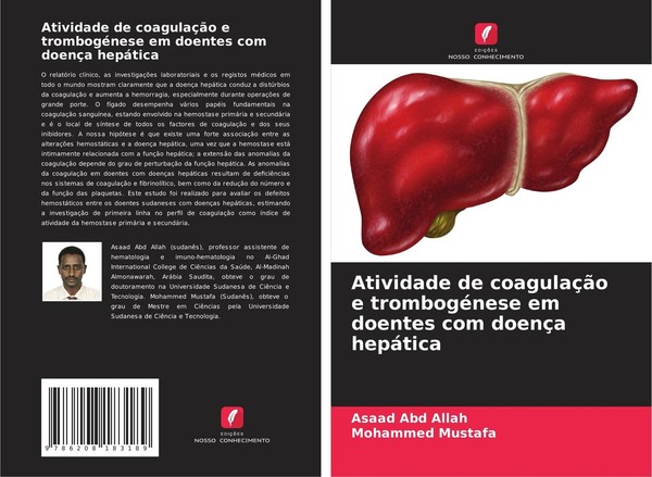 Atividade De CoagulaçãO E TrombogéNese Em Doentes Com DoençA HepáTica Asaad Abd-image