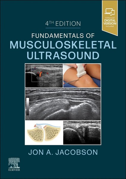Fundamentals Of Musculoskeletal Ultrasound | Jon A Jacobson | Englisch | Buch-image