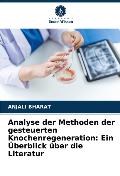 Analyse Der Methoden Der Gesteuerten Knochenregeneration: Ein ÜBerblick üBer Die-image