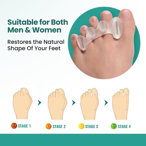 Toe Separators to Correct Bunion - Toe Spacers for Women Men, Relieve Feet Pa... - Bild 3 von 9