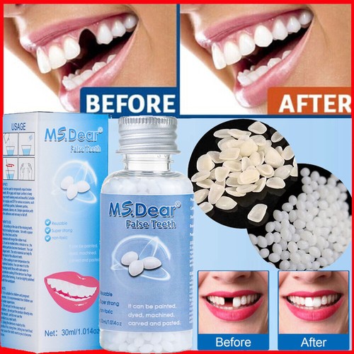 Tooth Repair Kit - Temporary Teeth Replacement Kit for Missing & Broken Teeth~ - Picture 3 of 23