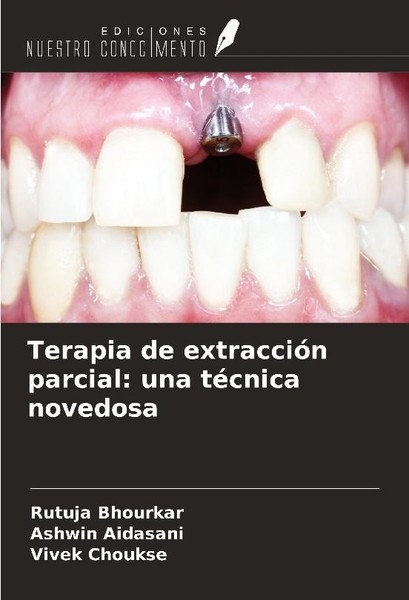 Terapia De ExtraccióN Parcial: Una TéCnica Novedosa Rutuja Bhourkar-image