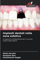 Impianti Dentali Nella Zona Estetica Shashikanth Hegde