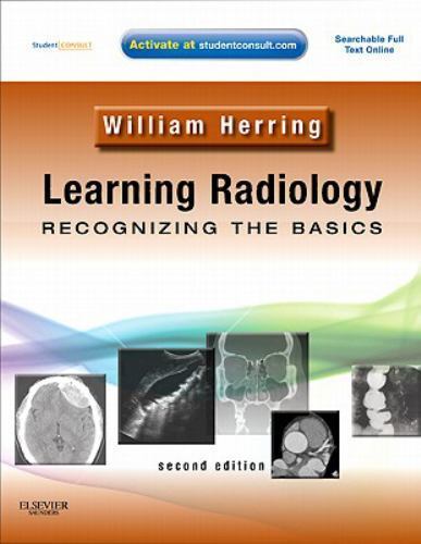Learning Radillogy Learning Radiology: Recognizing the Basics; With- 9780323074445 ...