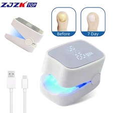 Anti Fungal Laser Device Finger Toe Nail Fungus Remover Onychomycosis 940nm500nm