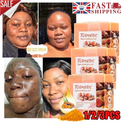 MS DEAR 1/3/5x Turmeric Soap Dark Spot Corrector Remove Wrinkles Tumeric Face Whitening