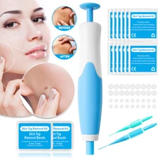 2in1 Auto Micro Skin Tag Remover Device Kit Safe Painless Removal Skin Care Tool