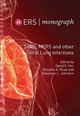 SARS, Mers and Other Viral Lung Infections: 72 (ERS Mono... Paperback / softback