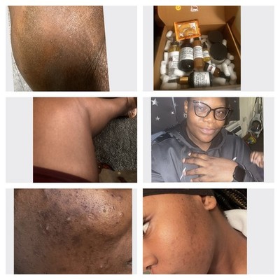 8 PCs Day & Night Skin Brightening, Face & Body Treatment, Hyperpigmentation