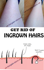Unisex Woman Men Ingrown Hair Removal Shaving Rash