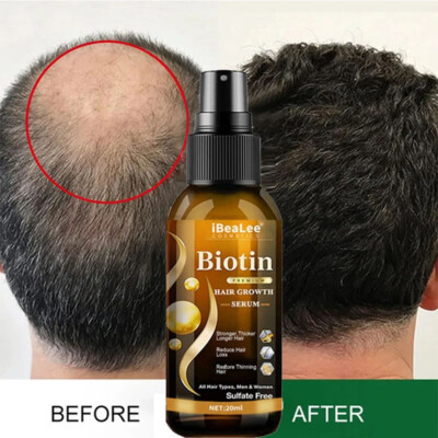 5x Biotin Hair Growth Regrowth quick Loss Anti Spray Hair Scalp Therapy Serum