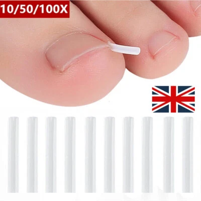 YANQUEENS 10-100x Ingrown Nail Pad Groove Foot Care Tool Toenail Corrector Pedicure Tool