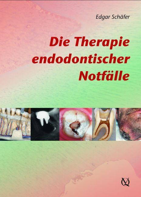 Thumbnail - Die Therapie Endodontischer Notfälle Edgar Schäfer