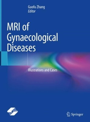 MRI OF GYNAECOLOGICAL DISEASES by ZHANG, GUOFU Hardback Self Help Business