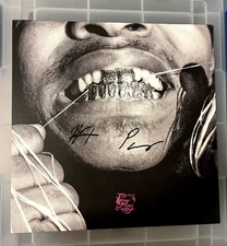 Injury Reserve Floss Signed Vinyl (Ritchie & Parker)