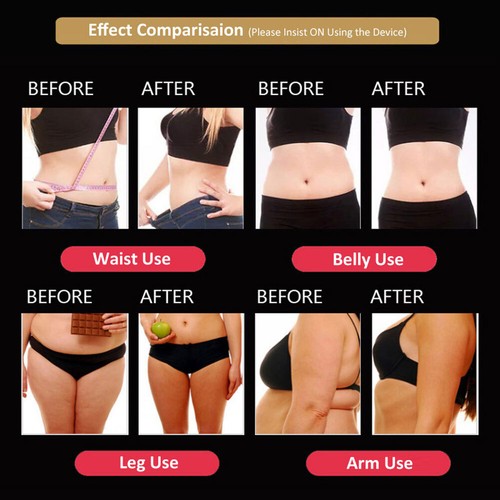 5-in1 Body Sculpting Machine RF Fat Burn Laser Vacuum Cavitati0n Slimming Device - Picture 7 of 16
