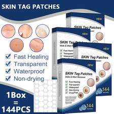 720PCS Skin Tag Remover Patches Quick Effective Mole Wart Removal Pad Sticker