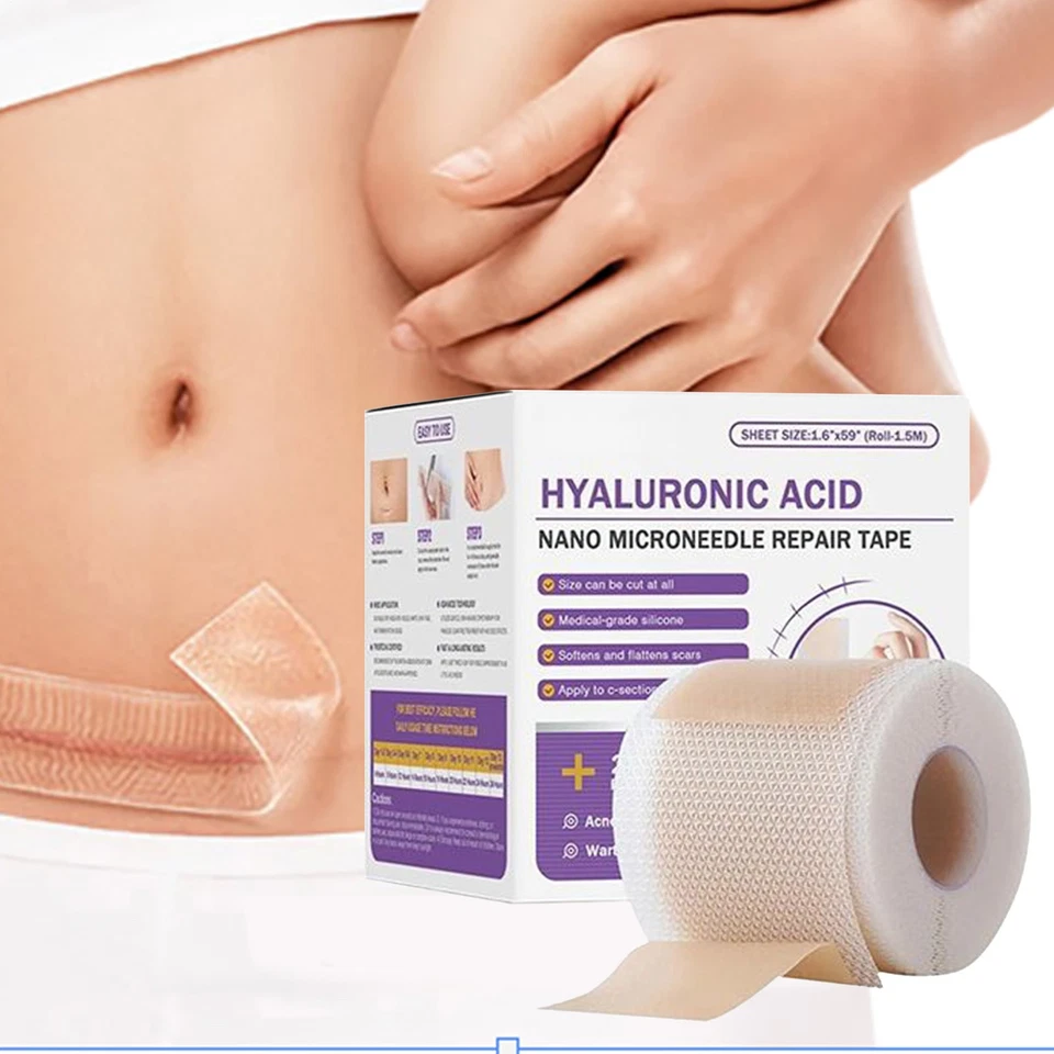 Hyaluronic Acid Silicone Scar Sheets,Silicone Scar Tape Soft & Comfortable Sheet - Image 3 of 4