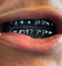 Black Gunmetal Removeable Mouth Teeth Grillz Upper & Lower Set + Molds