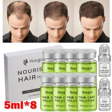 8Pcs Advanced Hair Growth Treatment Ginseng Hair Regrowth System Solution Set