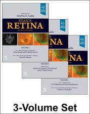 Ryans Retina