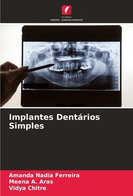 Implantes Dentários Simples Amanda Nadia Ferreira