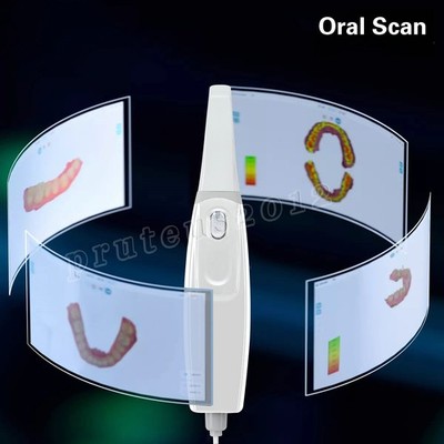 Dental Digital 3D Intraoral Scanner for Dentistry