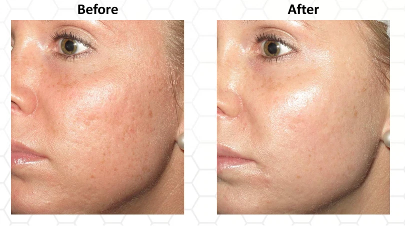 VITAMINA C 30% Suero Facial + ÁCIDO HIALURÓNICO + ÁCIDO FERÚLICO Gel Crema Antiedad Foto 2 de 4