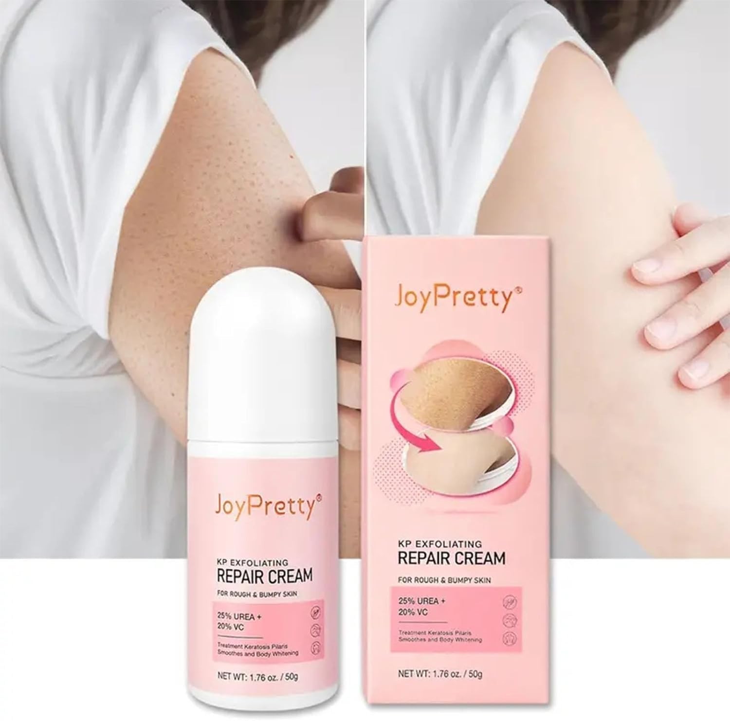 Keratosis Pilaris Lotion Legs Treatment Body Cream Skin Exfoliating Repair Skin