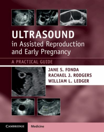 Ultrasound in Assisted Reproduction and Early Pregnancy : A Practical Guide ...