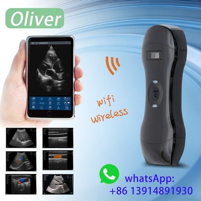 158E 3 in 1 Wireless Ultrasound probe Scanner Color Doppler  Linear/Convex Probe