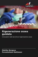 Mahika Borgave (U. A.) | Rigenerazione Ossea Guidata | Taschenbuch | Italienisch