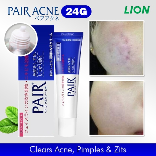 pair pimple cream