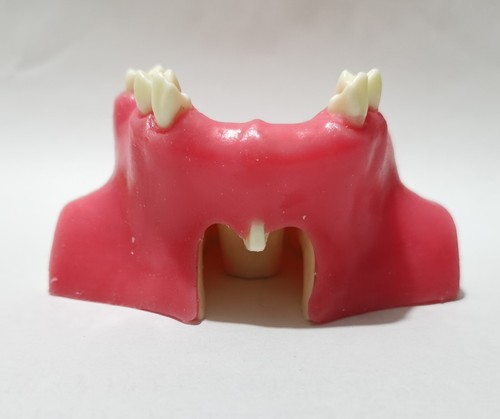 Dental Implant Maxillary Sinus Lift model Resin material Typodont Teeth - Picture 9 of 16
