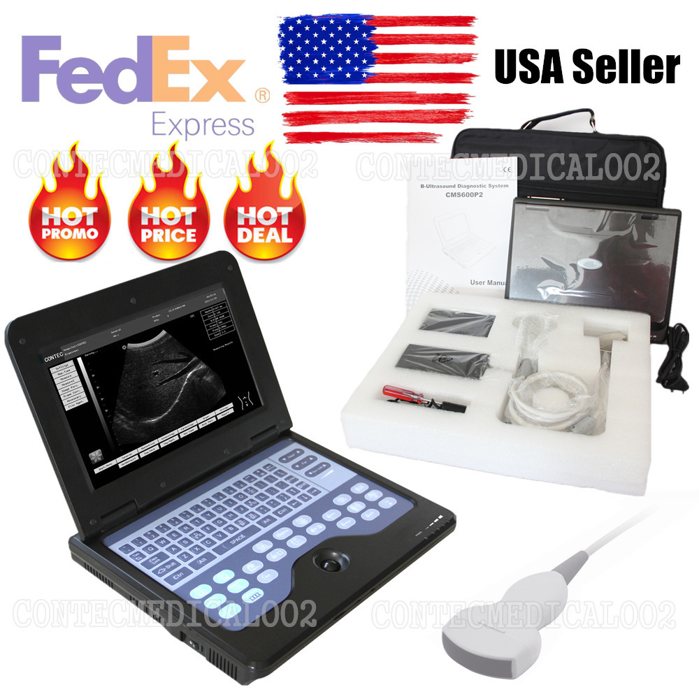 Portable laptop machine Digital Ultrasound scanner, Free 3.5Mhz Convex probe