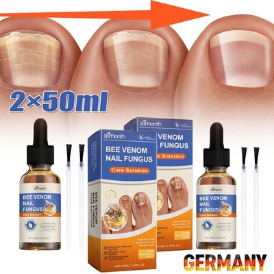 2 Stück Nail Care Serum Das Nagelpilz Stift für gepflegte Fingernägel Nagelpilz