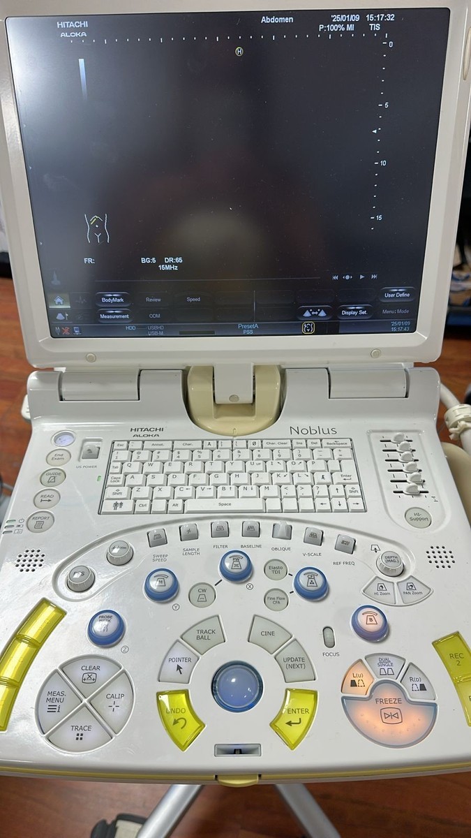 Hitachi Aloka Noblus Ultrasound ready for endoscopy and ultrasound