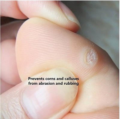 Of Foot Corn Heel Pain From Callus Large Oval Corn Pads Foot
