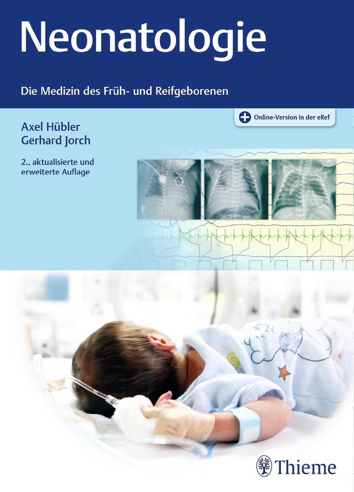 Thumbnail - Neonatologie Axel Hübler