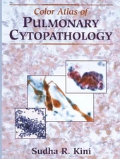 COLOR ATLAS OF PULMONARY CYTOPATHOLOGY By Sudha R. Kini & Pathology Images Inc.