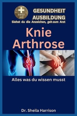 Knie-Arthrose: Alles, was Sie wissen m?ssen: Symptome, Ursachen, Diagnose, Behan
