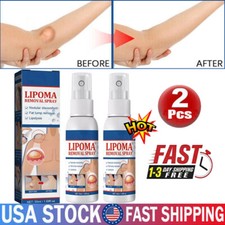 2X Lipomheilung Reduction Spray, Instant LumpFree Lipoma Removal Spray USA Hot