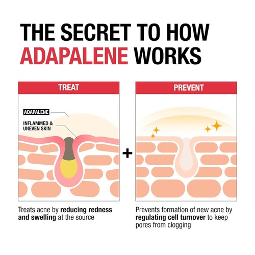 Neutrogena Adapalene Gel 0.1% Acne Treatment, 1.6 oz - Oil & Fragrance-Free Topi - Picture 4 of 9