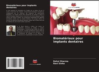 BiomatéRiaux Pour Implants Dentaires Ravi Sinha