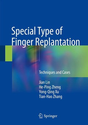 Jian Lin (u. a.) | Special Type of Finger Replantation | Buch | Englisch (2018)
